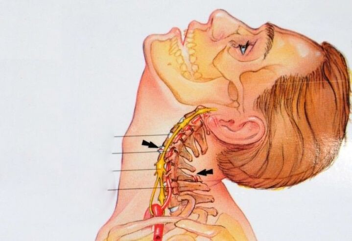 structura vertebrelor cervicale