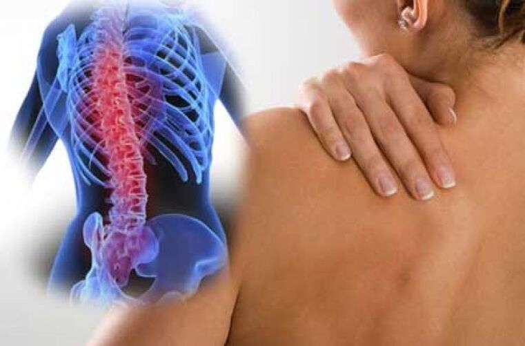 În timpul unei exacerbări a osteocondrozei coloanei vertebrale toracice, apare durere de dorsago. 