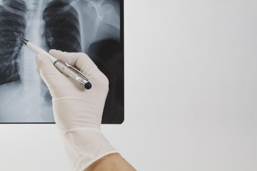 Radiografie pentru diagnosticarea osteocondrozei