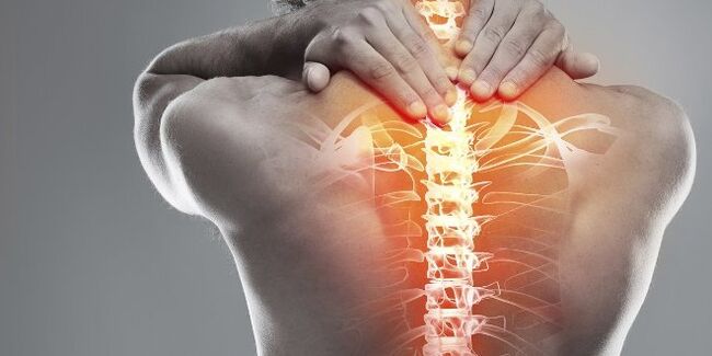 Opțiuni medicale pentru terapia cervicală a osteochondrozei cervicale