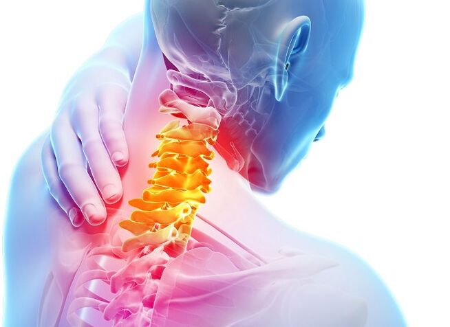 Simptome și etape ale dezvoltării osteochondrozei cervicale